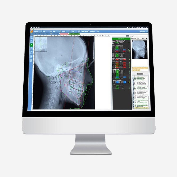 Dental Softwares - Audax Ceph Analysis Software